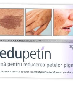 Crema pentru reducerea petelor pigmentare Redupetin